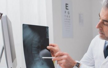 Do You Need Cervical Disc Replacement?